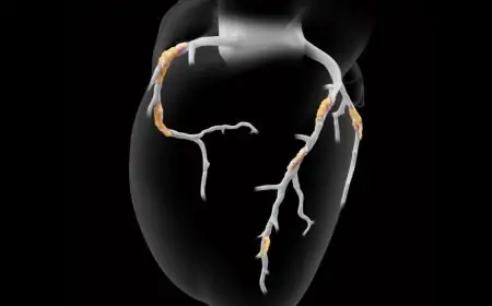 Heartflow, Inc. Announces Late-Breaking Data Validating AI-Driven Plaque Analysis for Coronary Risk