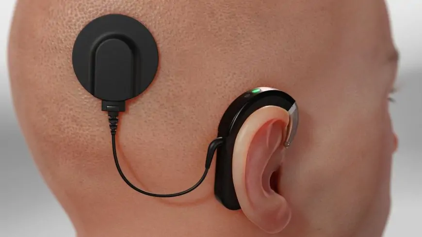 Cochlear Achieves Edge AI Breakthrough with Machine Learning Implants Inside Human Body